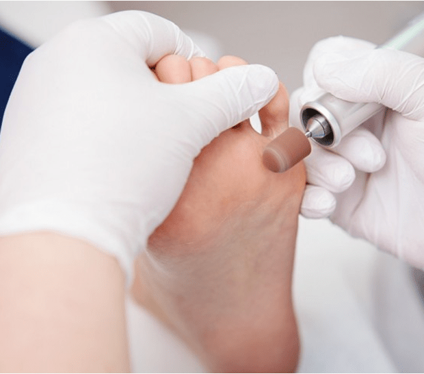 Usuwanie modzeli Warszawa